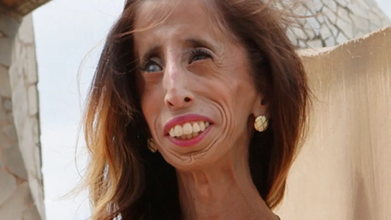 ‘World’s Ugliest Woman’ fights bullying with forgiveness